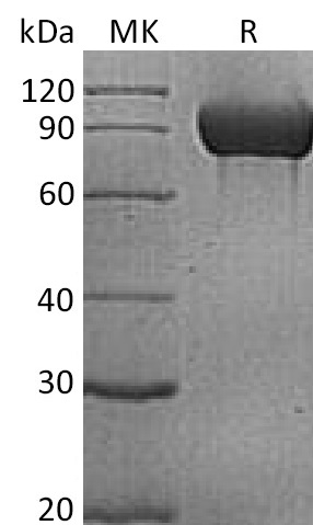 Human PECAM-1 +SDS-PAGE-1.jpg